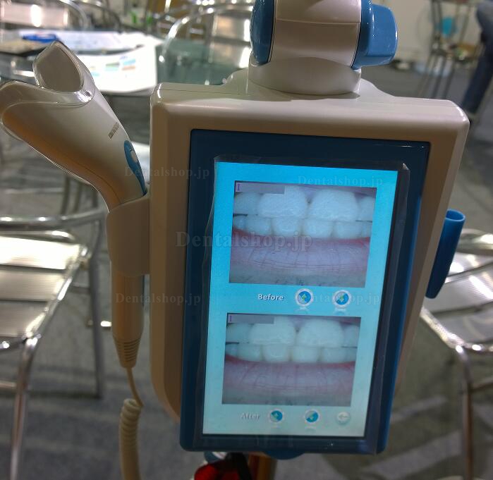 Magenta® MD887B歯科用ホワイトニング装置-カメラ機能搭載