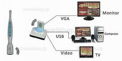 Magenta®歯科用·家庭用口腔内カメラMD9503OW 無線（USB2.0＆VGA、VIDEO）