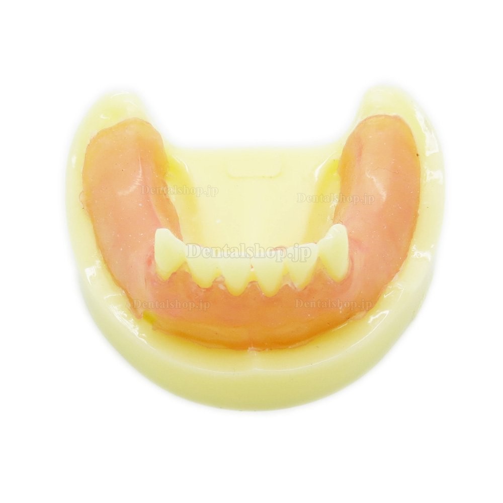 歯科練習用下顎義歯模型 歯科インプラント研究用標準教学道具 イエローベース
