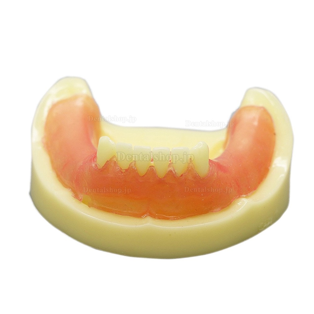 歯科練習用下顎義歯模型 歯科インプラント研究用標準教学道具 イエローベース