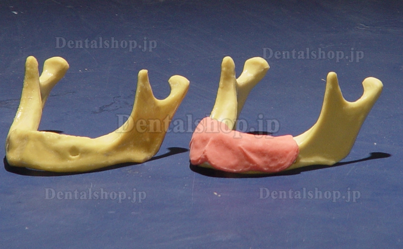 ENOVO®歯科口腔外科インプラント実習用下顎骨模型