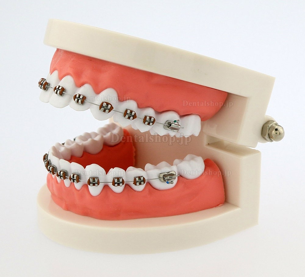 歯科モデル 歯列矯正 模型 研究教学用モデル ブレース付き 5006