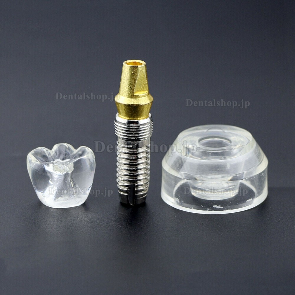歯科インプラント模型 2.5X サイズ取り外し可能透明