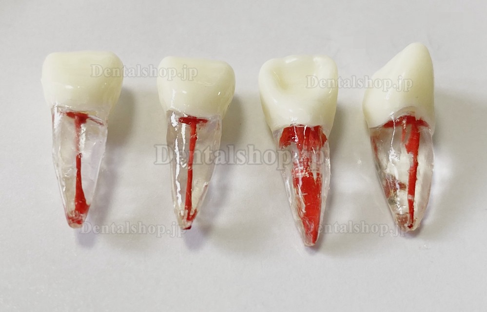 歯科用歯モデル 根管ファイル練習模型 臼歯上下歯小臼歯 ルート2/3-根管