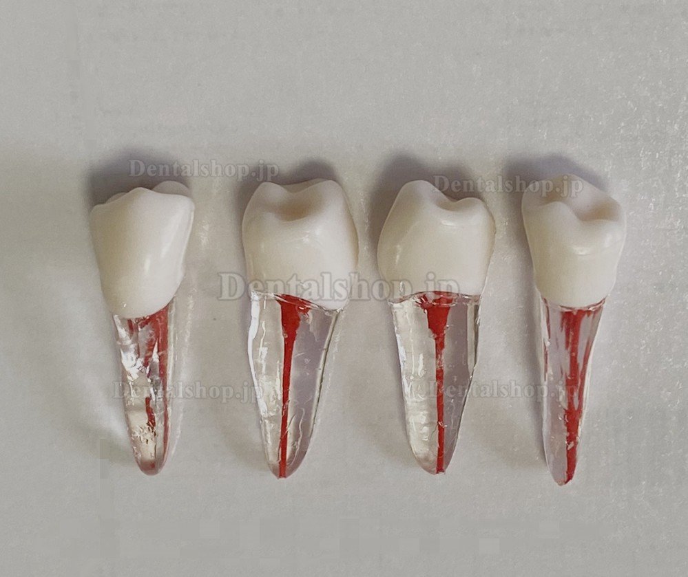 歯科用歯モデル 根管ファイル練習模型 臼歯上下歯小臼歯 ルート2/3-根管