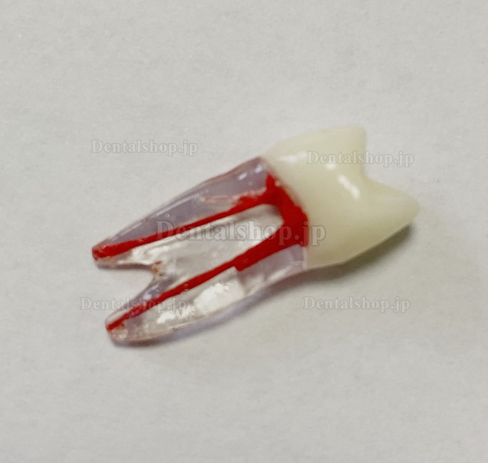 歯科用歯モデル 根管ファイル練習模型 臼歯上下歯小臼歯 ルート2/3-根管