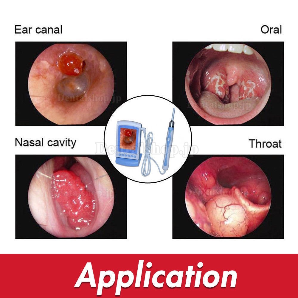 オトスコープ TVビデオ耳検査カメラ