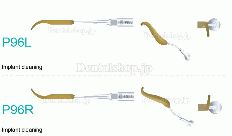 5Pcs Refine® 歯科用スケーラーチップ P90 P94 P95 P96L P96R EMS MECTRON Woodpeakerに適用