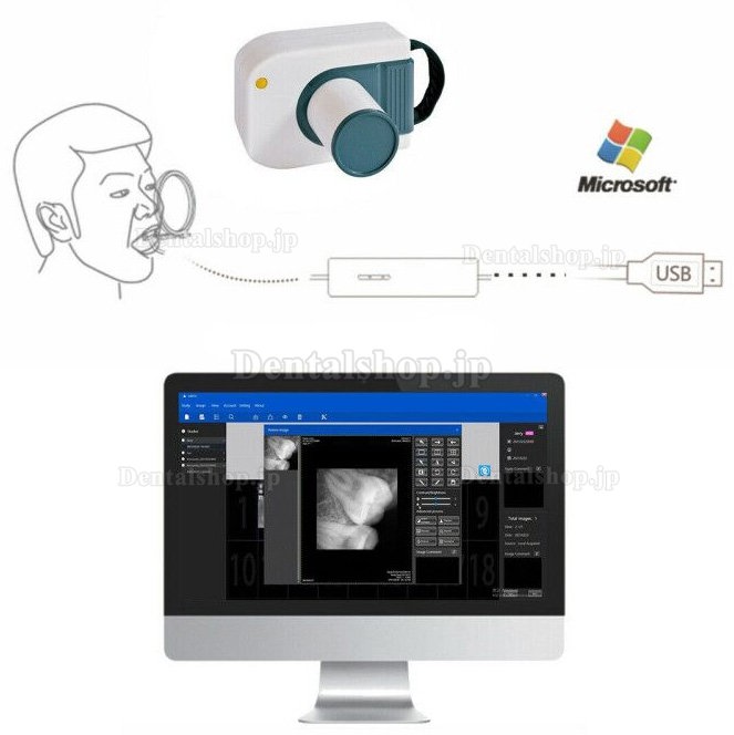 歯科用デジタル画像 RVG X線センサー 歯科口腔内イメージングシステム