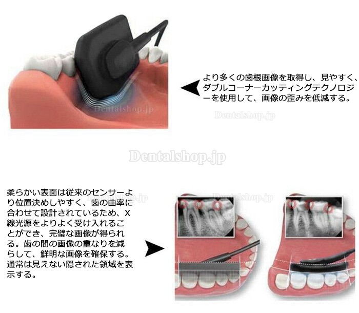 歯科用デジタル画像 RVG X線センサー 歯科口腔内イメージングシステム