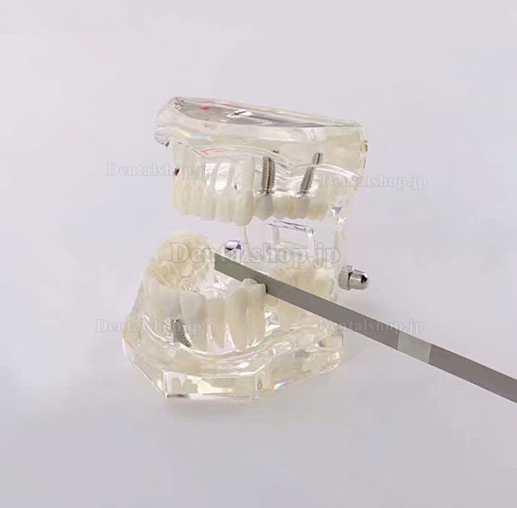 10本歯科精密20-70um 2.5-6mm歯科矯正IPRダイヤモンドストリップ医学砂片面
