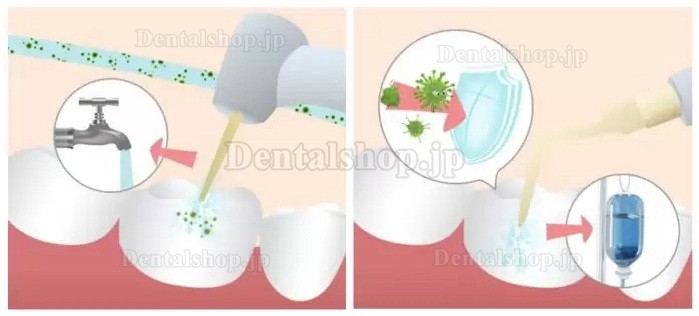 Refine MaxSurgery 超音波骨切削器 歯科用超音波手術ユニット