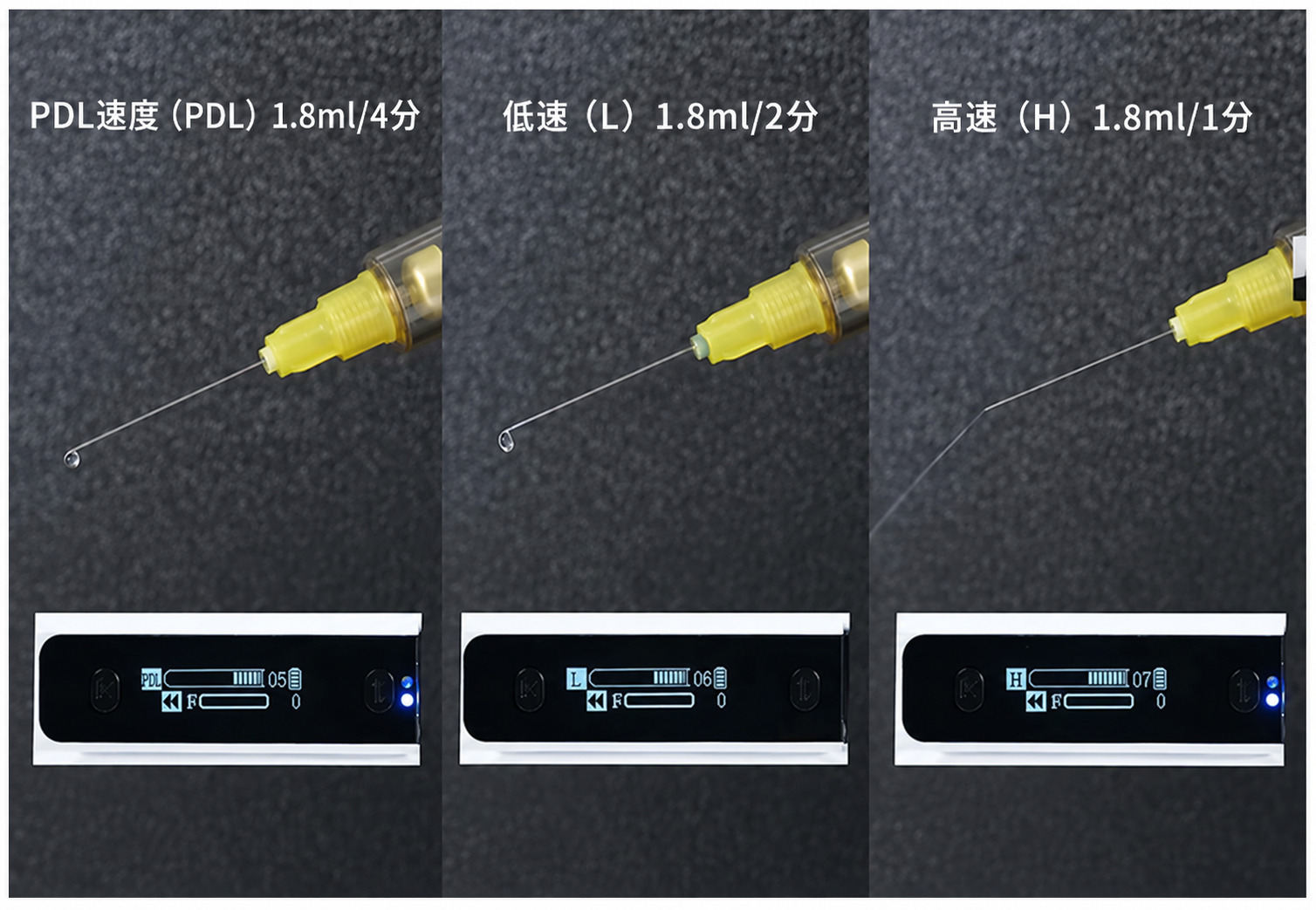 SOGA Smart I 歯科用電動麻酔注射器 痛みのない歯科麻酔ペン SOGA Smart I 歯科用電動麻酔注射器 痛みのない歯科麻酔ペン