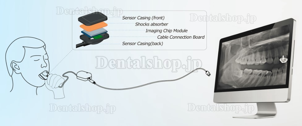 歯科用デジタルX線センサー USB デジタル口腔内センサー + 500シース