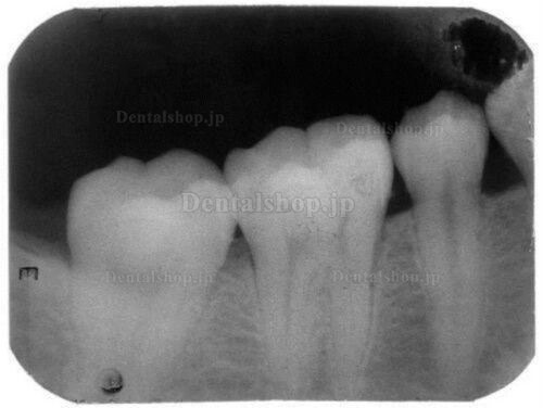 Tianjie 歯科ポータブルX線診断装置 BLX-9
