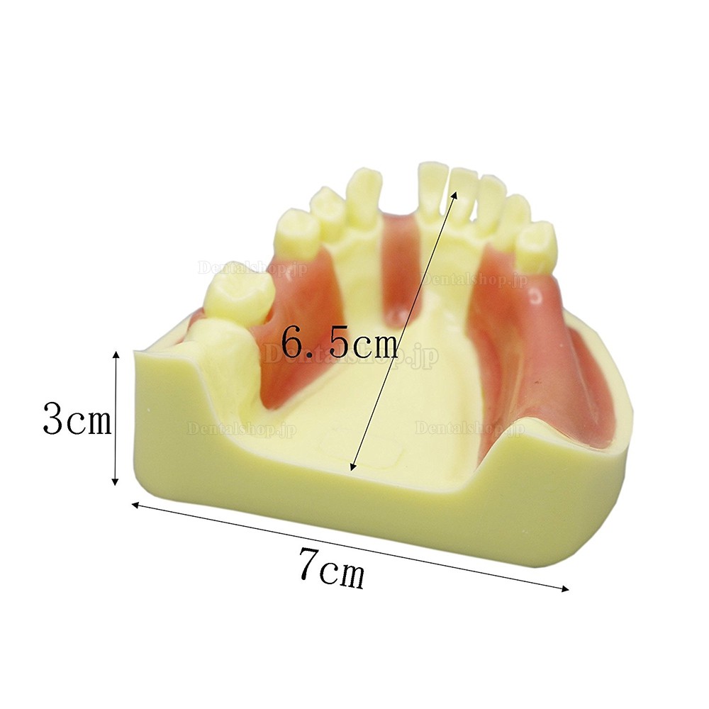 歯科下顎義歯模型 インプラント研究練習用道具 標準教学道具 イエローベース