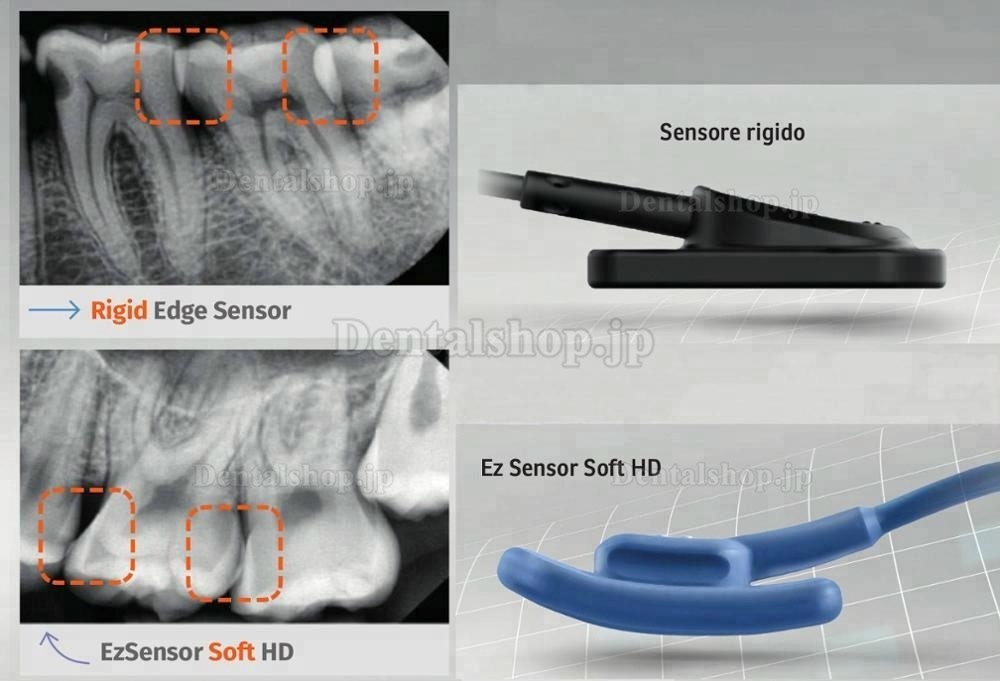 VATECH EZSensor ソフトタイプ歯科用X線センサー 