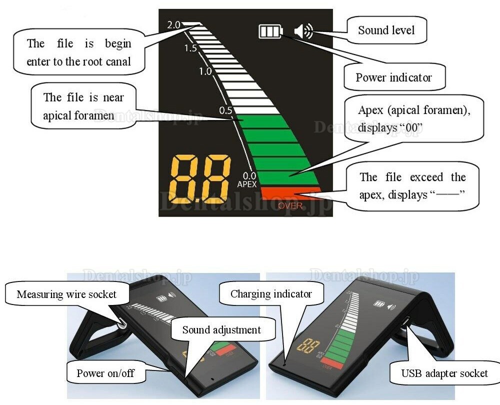 歯科用ワイヤレスエンドモーター + Westcode 歯科用ミニ根管長測定器キット
