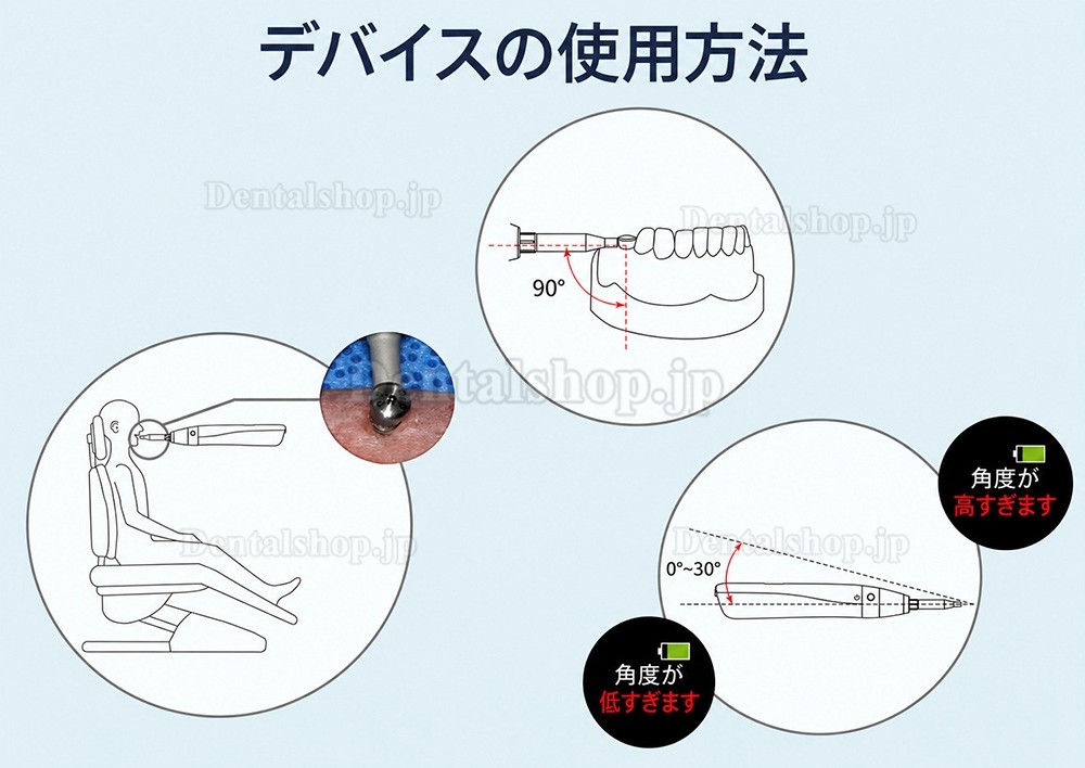 YAHOPE iCHECK 手持ち型インプラント安定性測定器 ISQ値測定器
