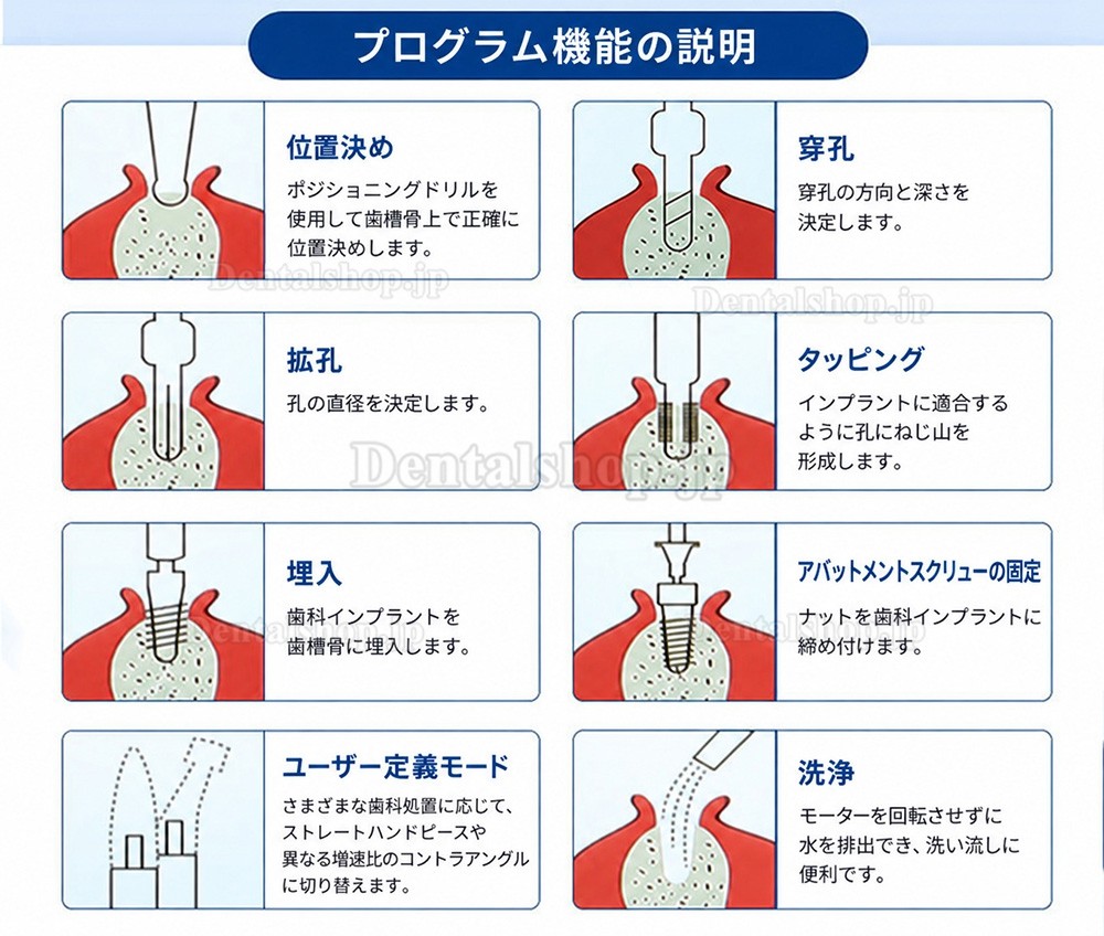 Yahope IMPLANT surg 歯科インプラントユニットインプラントモーター