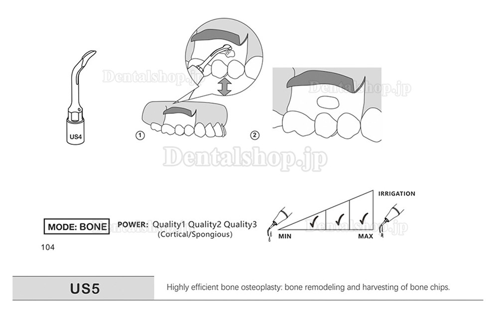 1Pcs 歯科用ピエゾサージェリーチップ 骨切り術 歯科手術チップ US1 US1L US1R US2 US3 US4 US5 US6 US7 US11 US12 Mectron Woodpeckerに適用