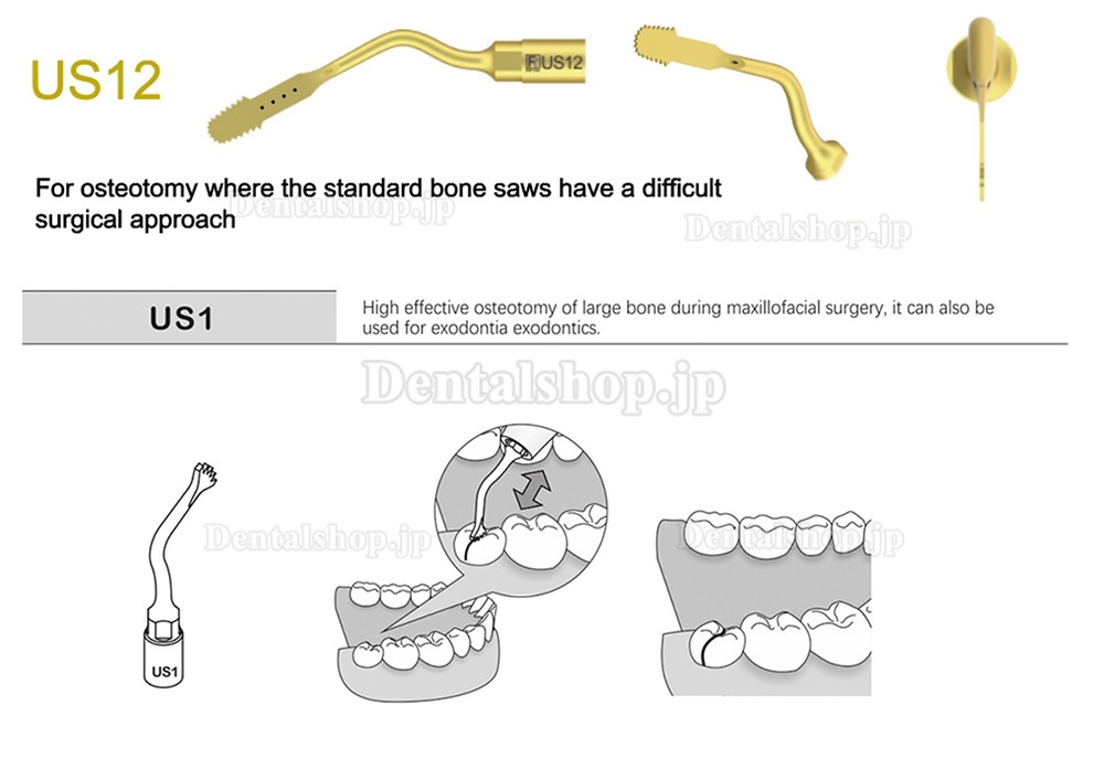 1Pcs 歯科用ピエゾサージェリーチップ 骨切り術 歯科手術チップ US1 US1L US1R US2 US3 US4 US5 US6 US7 US11 US12 Mectron Woodpeckerに適用
